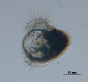 A small veliger larva of a snail under a microscope. The cilia on the lobes assist with movement.