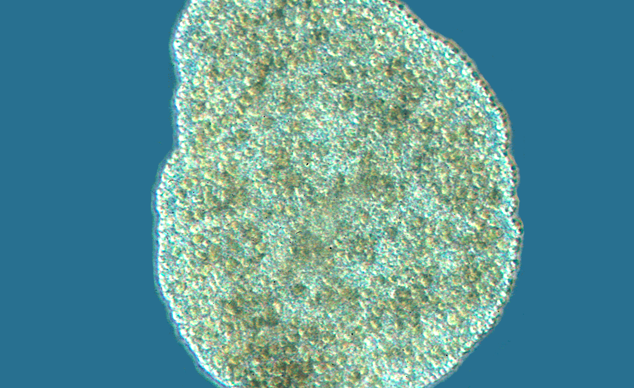 The placozoa Trichoplax adhaerens