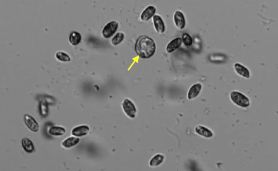 P. balticum entrapping eukaryotes in its mucosphere