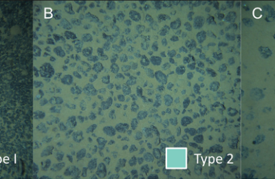The patchy quilt of the deep-sea: polymetallic nodule fields